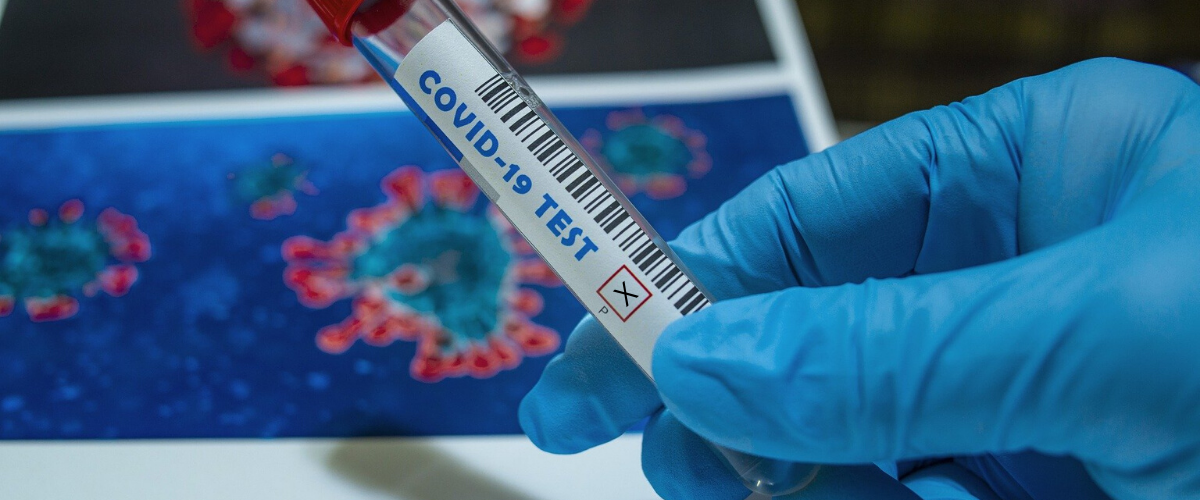 Nicaragua acumula 1464 casos de coronavirus y 55 muertes por esta causa