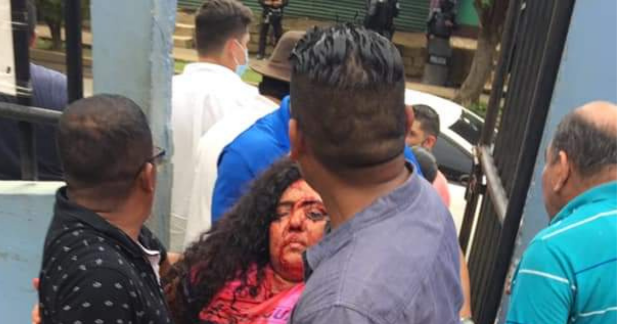 Verónica Chávez fue trasladada al hospital Humberto Alvarado de Masaya