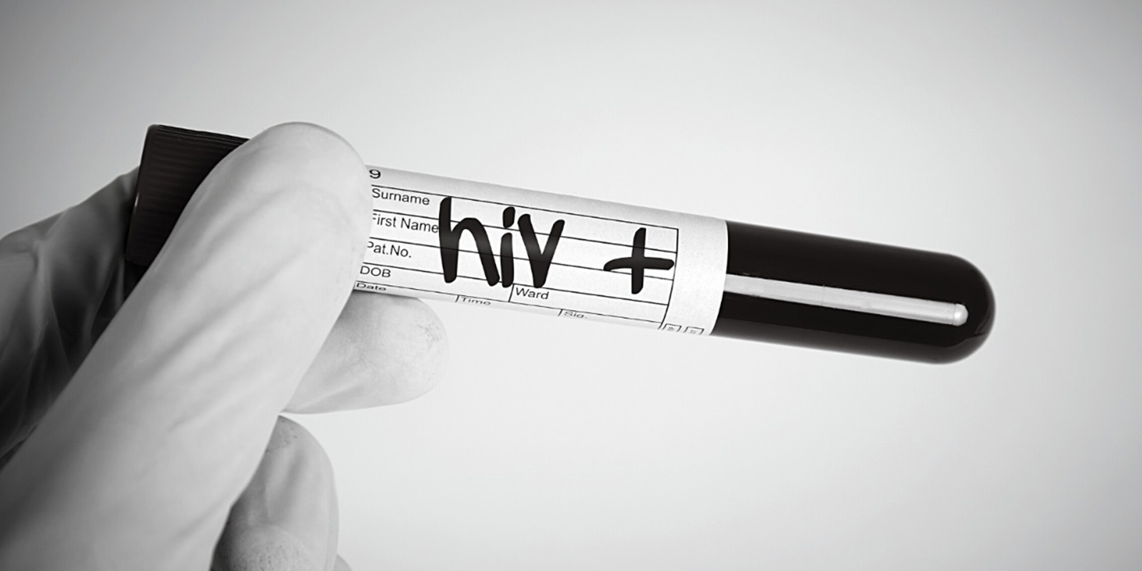 No hablar del VIH es no hablar de la "bomba de tiempo"