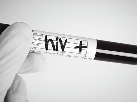 No hablar del VIH es no hablar de la "bomba de tiempo"