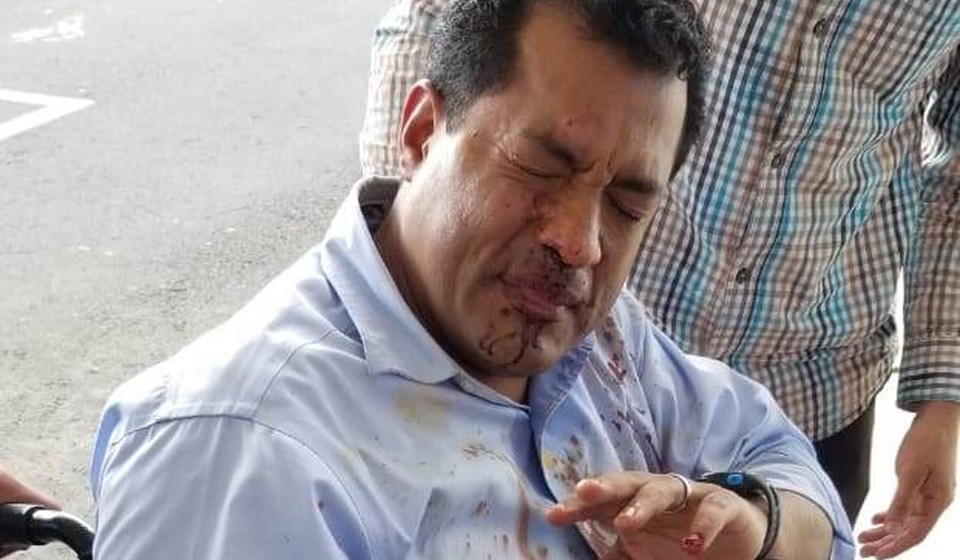  Paramilitares dirigen ataque a Félix Maradiaga