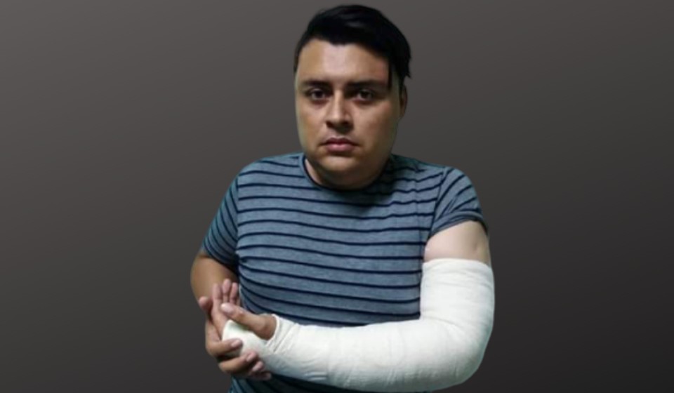  Policía Orteguista le fractura un brazo a reportero de Canal 12