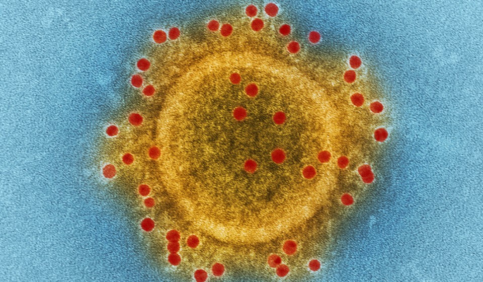  Ministerio de Salud confirma 1,118 casos de coronavirus en Nicaragua